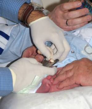 Circoncision juive - © 2005 Odelia Cohen - Agence: iStockPhoto. Circoncision juive - © 2005 Odelia Cohen - Agence: iStockPhoto.