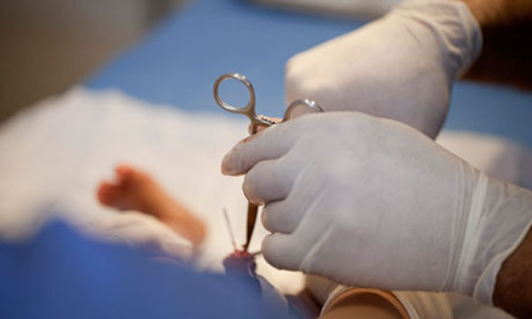 La circoncision en France : illégale mais « admise »