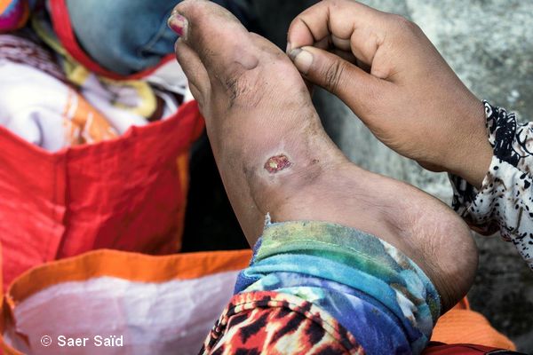 Lors de la halte autorisée avant le passage coté autrichien, une Afghane essaie de panser ses pieds meurtris par la marche. Frontières austro-hongroises, octobre 2015. © Saer Saïd