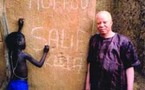 La Fondation Salif Keita pour les albinos du Mali